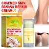 Jaysuing Foot Cream, Moisturizes Skin To Skin Cracking, Dry And Itchy Foot Care And Cream