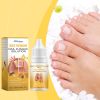 South Moon Bee Venom Nail Care Essence Foot Gray Nails Brightening Nails Rotten Nails Soft Nails Nail Care
